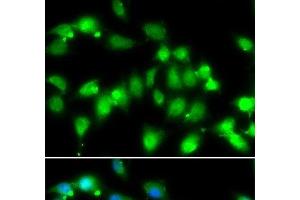 Immunofluorescence analysis of HeLa cells using AKAP5 Polyclonal Antibody at dilution of 1:100. (AKAP5 Antikörper)