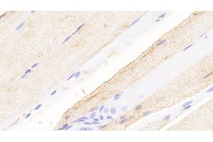 Detection of NMU in Rat Skeletal muscle Tissue using Polyclonal Antibody to Neuromedin U (NMU) (Neuromedin U Antikörper  (AA 38-174))