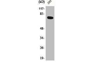 Western Blot analysis of 293 cells using Actinin-α1/2/3/4 Polyclonal Antibody (ACTN1 Antikörper  (N-Term))