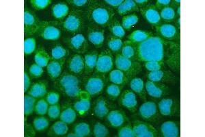 IF analysis of ICAM1 using anti-ICAM1 antibody (ABIN5692991). (ICAM1 Antikörper  (AA 28-268))