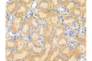 ABIN6258273 and ABIN6274214 at 1/100 staining Rat lung tissue by IHC-P. (MARK3 Antikörper  (N-Term))