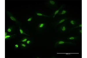 Immunofluorescence of purified MaxPab antibody to PKNOX1 on HeLa cell. (PKNOX1 Antikörper  (AA 1-436))