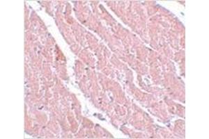 Immunohistochemistry of ATG13 in mouse heart with ATG13 antibody at 5 μg/ml. (ATG13 Antikörper  (C-Term))