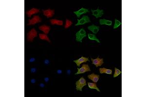 ABIN6264247 and ABIN6269325 staining HepG2 cells by IF/ICC. (PKC zeta Antikörper  (C-Term))