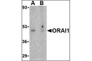 Western blot analysis of ORAI1 in human ovary tissue lysate with this product at 1 μg/ml in the (A) absence or (B) presence of blocking peptide.