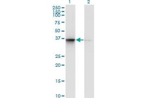 Western Blot analysis of TSNAXIP1 expression in transfected 293T cell line by TSNAXIP1 monoclonal antibody (M02), clone 1D6. (Tsnaxip1 Antikörper  (AA 269-364))