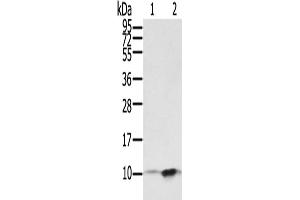 Western Blotting (WB) image for anti-S100 Calcium Binding Protein P (S100P) antibody (ABIN2829040) (S100P Antikörper)