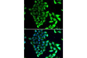Immunofluorescence analysis of MCF-7 cells using MID1 antibody (ABIN5974393). (MID1 Antikörper)
