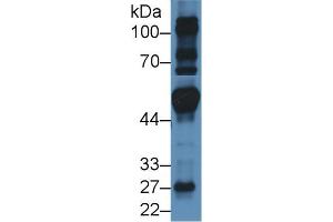 Western blot analysis of Mouse Heart lysate, using Human FRS2 Antibody (3 µg/ml) and HRP-conjugated Goat Anti-Rabbit antibody ( (FRS2 Antikörper  (AA 239-449))