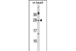 MSC Antibody (C-term) (ABIN1536771 and ABIN2849429) western blot analysis in mouse heart tissue lysates (35 μg/lane).