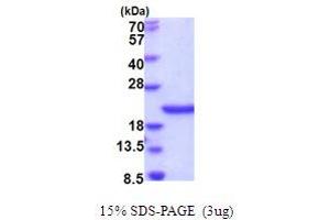 SDS-PAGE (SDS) image for SCO1 Cytochrome C Oxidase Assembly Protein (SCO1) (AA 132-301) protein (His tag) (ABIN5854030)