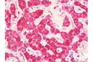 Immunohistochemistry (IHC) image for anti-Ubiquinol-Cytochrome C Reductase Core Protein I (UQCRC1) (AA 46-305) antibody (ABIN2629761)
