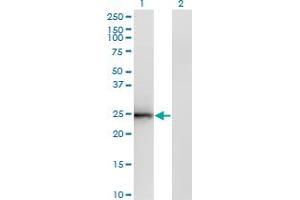 Western Blotting (WB) image for anti-Cell Death-Inducing DFFA-Like Effector B (CIDEB) (AA 3-111) antibody (ABIN599215) (CIDEB Antikörper  (AA 3-111))