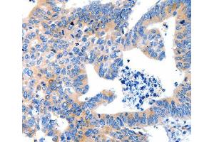 Immunohistochemistry (IHC) image for anti-Low Density Lipoprotein Receptor-Related Protein Associated Protein 1 (LRPAP1) antibody (ABIN1680715) (LRPAP1 Antikörper)