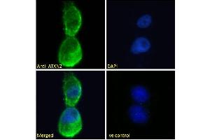 ABIN570879 Immunofluorescence analysis of paraformaldehyde fixed U2OS cells, permeabilized with 0. (Ataxin 2 Antikörper  (Internal Region))