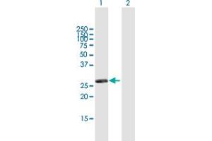 Western Blot analysis of RASSF3 expression in transfected 293T cell line by RASSF3 MaxPab polyclonal antibody. (RASSF3 Antikörper  (AA 1-238))