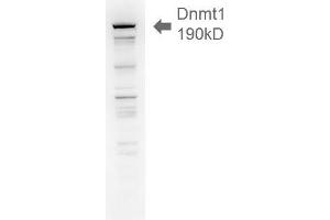 Dnmt1, 18ug H1299 lysate 1 in1000 Western Blotting. (DNMT1 Antikörper  (AA 637-650))