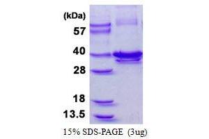 Image no. 1 for Calponin 1 (CNN1) protein (His tag) (ABIN1098634)