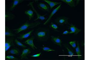 Immunofluorescence of purified MaxPab antibody to CETN3 on HeLa cell. (CETN3 Antikörper  (AA 1-167))