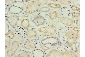 Immunohistochemistry of paraffin-embedded human kidney tissue using ABIN7157726 at dilution of 1:100 (KLF3 Antikörper  (AA 1-240))