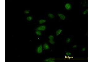 Image no. 4 for anti-CDK5 Regulatory Subunit Associated Protein 3 (CDK5RAP3) (AA 1-507) antibody (ABIN599311) (CDK5RAP3 Antikörper  (AA 1-507))