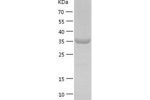 Western Blotting (WB) image for Speckle-Type POZ Protein (SPOP-B) (AA 1-374) protein (His tag) (ABIN7284492) (SPOP-B Protein (AA 1-374) (His tag))