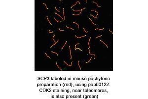 Image no. 1 for anti-Synaptonemal Complex Protein 3 (SYCP3) (C-Term) antibody (ABIN363431)