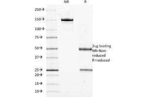 SDS-PAGE Analysis of Purified, BSA-Free Cytokeratin 18 Antibody (clone DE-K18). (Cytokeratin 18 Antikörper)