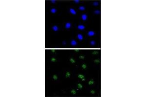 Confocal immunofluorescent analysis of PTEN antibody with 293 cells followed by Alexa Fluor 488-conjugated goat anti-rabbit lgG (green). (PTEN Antikörper  (AA 306-335))