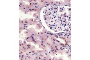 Immunohistochemistry (Paraffin-embedded Sections) (IHC (p)) image for anti-Interleukin-1 Receptor-Associated Kinase 1 (IRAK1) (AA 348-381), (pSer376) antibody (ABIN6241064)