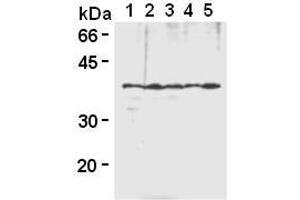 Western Blotting (WB) image for anti-Heterogeneous Nuclear Ribonucleoprotein A2/B1 (HNRNPA2B1) antibody (ABIN1449240) (HNRNPA2B1 Antikörper)