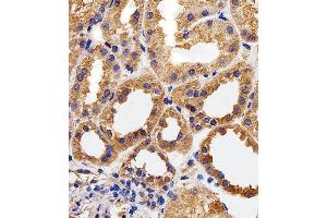 Paraformaldehyde-fixed, paraffin embedded human kidney tissue, Antigen retrieval by boiling in sodium citrate buffer (pH6. (CAPNL1 Antikörper)