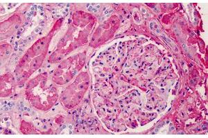 Human Kidney: Formalin-Fixed, Paraffin-Embedded (FFPE) (APOA1 Antikörper)