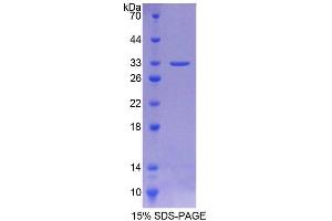 SDS-PAGE (SDS) image for Aurora Kinase C (AURKC) (AA 92-339) protein (His tag) (ABIN6238701) (Aurora Kinase C Protein (AURKC) (AA 92-339) (His tag))