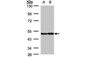 WB Image Sample(30 μg of whole cell lysate) A:A431, B:H1299 10% SDS PAGE antibody diluted at 1:2000 (ENO2/NSE Antikörper)