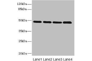 Western blot All lanes: INHBB antibody at 2 μg/mL Lane 1: U87 whole cell lysate Lane 2: A549 whole cell lysate Lane 3: A431 whole cell lysate Lane 4: Hela whole cell lysate Secondary Goat polyclonal to rabbit IgG at 1/10000 dilution Predicted band size: 46 kDa Observed band size: 46 kDa (INHBB Antikörper  (AA 295-405))