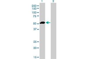 Western Blot analysis of F9 expression in transfected 293T cell line by F9 monoclonal antibody (M01), clone 2C9. (Coagulation Factor IX Antikörper  (AA 96-190))