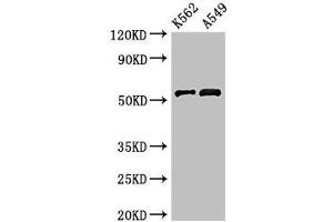 Western Blot Positive WB detected in: K562 whole cell lysate, A549 whole cell lysate All lanes: CELF2 antibody at 3 μg/mL Secondary Goat polyclonal to rabbit IgG at 1/50000 dilution Predicted band size: 55, 53, 56 kDa Observed band size: 55 kDa (CELF2 Antikörper  (AA 291-381))
