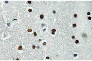 Immunohistochemistry (IHC) analyzes of ASCL1 antibody in paraffin-embedded human brain tissue. (ASCL1 Antikörper)