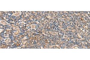 Immunohistochemistry of paraffin-embedded Human tonsil tissue using SEC22B Polyclonal Antibody at dilution of 1:60(x200) (SEC22B Antikörper)