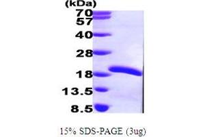 SDS-PAGE (SDS) image for Ubiquitin-Conjugating Enzyme E2 Variant 2 (UBE2V2) (AA 1-145) protein (His tag) (ABIN667160) (UBE2V2 Protein (AA 1-145) (His tag))