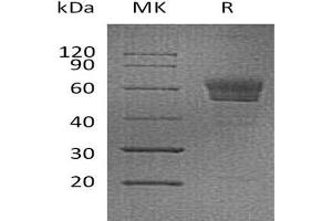 Western Blotting (WB) image for Podoplanin (PDPN) protein (Fc Tag) (ABIN7320788) (Podoplanin Protein (PDPN) (Fc Tag))