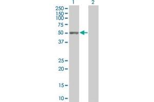 Western Blot analysis of C9orf68 expression in transfected 293T cell line by C9orf68 MaxPab polyclonal antibody. (C9orf68 Antikörper  (AA 1-392))