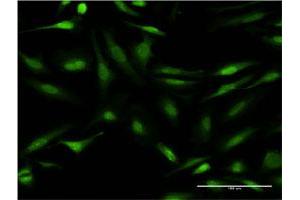 Immunofluorescence of monoclonal antibody to CALCOCO2 on HeLa cell. (CALCOCO2 Antikörper  (AA 347-446))