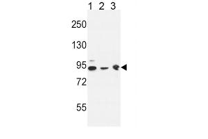 Western Blotting (WB) image for anti-DnaJ (Hsp40) Homolog, Subfamily C, Member 6 (DNAJC6) antibody (ABIN3004410)