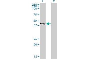 Western Blotting (WB) image for anti-Proteasome (Prosome, Macropain) 26S Subunit, ATPase, 6 (PSMC6) (AA 290-389) antibody (ABIN519392)