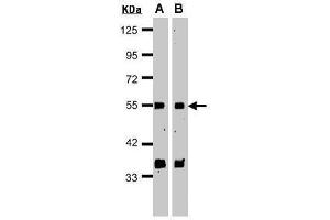WB Image Sample(30 μg of whole cell lysate) A:HeLa S3 , B:MOLT4 , 15% SDS PAGE antibody diluted at 1:1000 (GPS1 Antikörper  (C-Term))