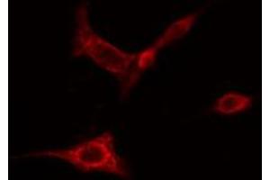 ABIN6274827 staining HeLa cells by IF/ICC.