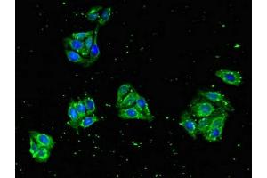 Immunofluorescent analysis of HepG2 cells using ABIN7151001 at dilution of 1:100 and Alexa Fluor 488-congugated AffiniPure Goat Anti-Rabbit IgG(H+L) (ZNF645 Antikörper  (AA 200-413))