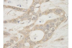 Immunohistochemistry (IHC) image for anti-BCL2-Associated Agonist of Cell Death (BAD) (AA 1-50) antibody (ABIN7448932) (BAD Antikörper  (AA 1-50))